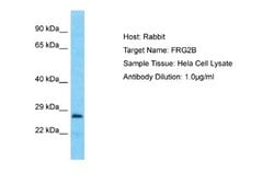 FRG2B Rabbit anti-Human, Polyclonal, Novus Biologicals 0.1ml; Unconjugated:Antibodies,